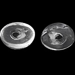 5 Ovale glasskuler til å fylle